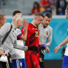 6 كسور في وجه لاعب بلجيكا